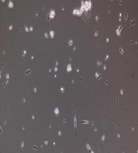 人心肌细胞,Cardiomyocytes Cells