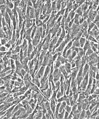 人脉络膜成纤维细胞,Human choroidal fibroblast cells