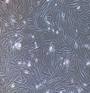 人胎盤間充質(zhì)干細胞,Placental Mesenchymal Stem Cells