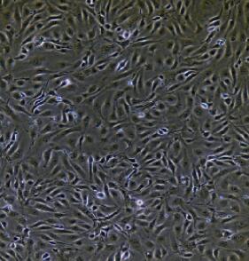 人臍靜脈內(nèi)皮細(xì)胞,Umbilical Vein Endothelial Cells