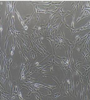 人脐带间充质干细胞,Human Umbilical Cord mesenchymal Stem Cells
