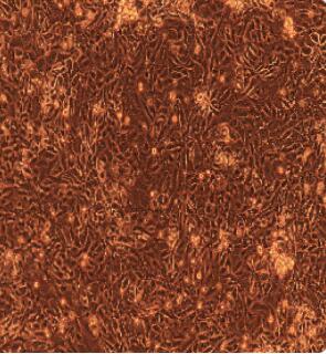 人食管上皮細胞,Esophageal Epithelial Cells