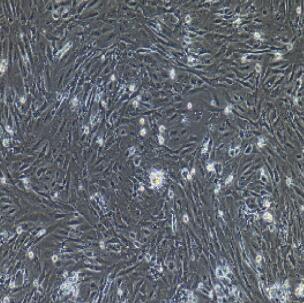 人小肠成纤维细胞,Small Intestinal Fibroblasts Cells