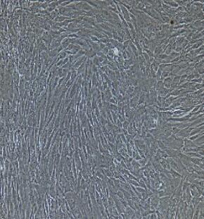 人胃成纤维细胞,Gastric Fibroblasts Cells