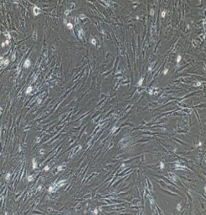 人結(jié)腸成纖維細(xì)胞,Colon Fibroblasts Cells