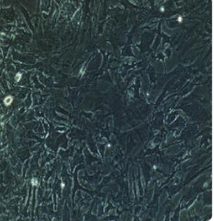 人肝星状细胞,Human Hepatic Stellate Cells