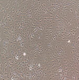 人肝窦内皮细胞,Human Hepatic Sinusoidal Endothelial Cells