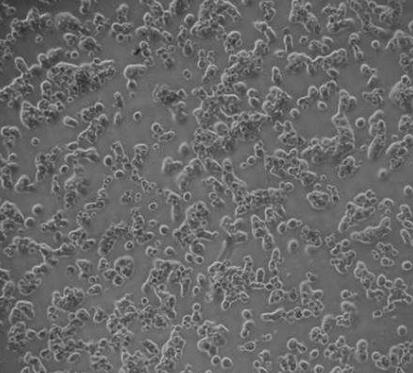 人肝实质细胞,Human Hepatic Parenchyma Cells