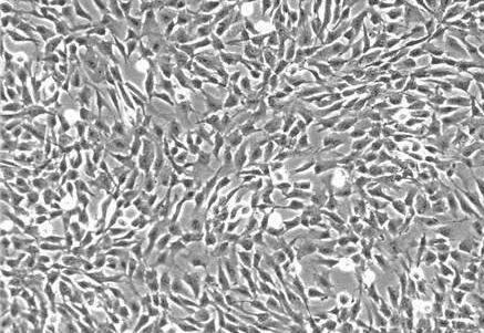 人胆囊成纤维细胞,Human Cholecystokinoblasts Cells