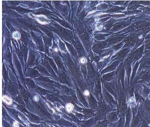 人胆囊平滑肌细胞,Human Gallbladder Smooth Muscle Cells