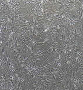 人肝成纤维细胞,Human Liver Fibroblasts Cells