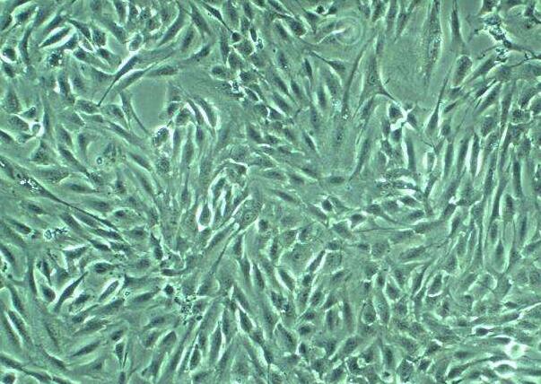 人脾脏小梁平滑肌细胞,Human Spleen Trabecular Muscle Cells