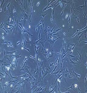 人直肠平滑肌细胞,Human Rectal Smooth Muscle Cells