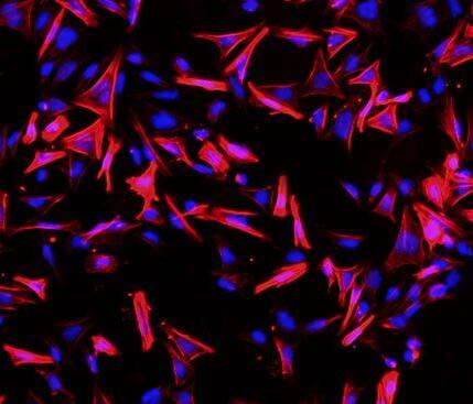 人胃上皮细胞,Human Gastric Epithelial Cells