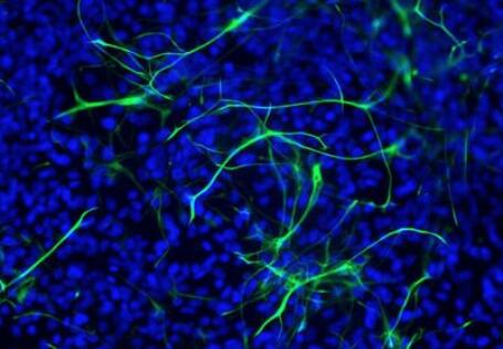 人神經(jīng)干細(xì)胞,Human neural stem cell