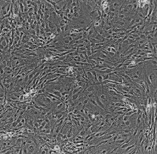 大鼠主动脉内皮细胞,Rat Aortic Endothelial Cells