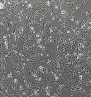大鼠主动脉平滑肌细胞,Rat Aortic Smooth Muscle Cells