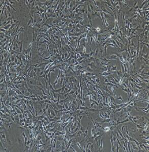 大鼠冠状动脉内皮细胞,Rat Coronary Artery Endothelial Cells