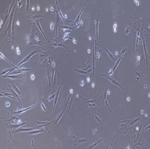 大鼠冠狀動脈平滑肌細胞,Rat Coronary Artery Smooth Muscle Cells