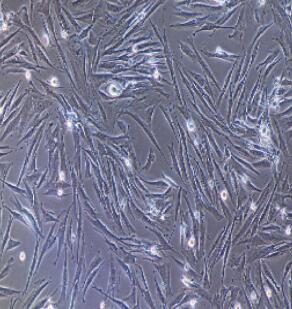 大鼠頸動(dòng)脈平滑肌細(xì)胞,Rat Carotid Artery Smooth Muscle Cells