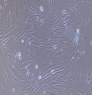 大鼠腹腔主動(dòng)脈平滑肌細(xì)胞,Rat Abdominal Aortic Smooth Muscle Cells