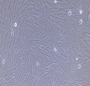 大鼠腹腔主动脉外膜成纤维细胞,Rat Abdominal Aortic Adventitial Fibroblasts Cells