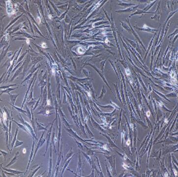 大鼠股动脉平滑肌细胞,Rat Femoral Artery Smooth Muscle Cells