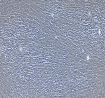 大鼠食管成纤维细胞,Rat Esophageal Fibroblasts Cells