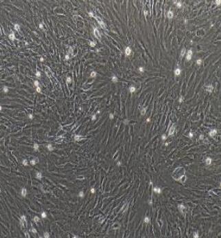 大鼠胰腺星狀細胞,Rat Pancreatic Stellate Cells