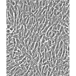 人脉络膜成纤维细胞