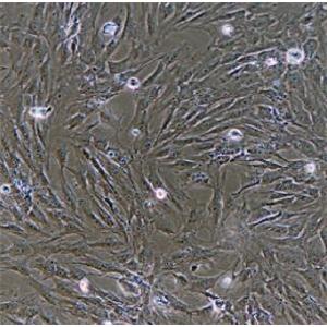 人肝癌细胞,Primary Cell Of Liver Cancer