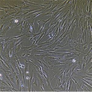 人直肠成纤维细胞,Rectal Fibroblasts Cells