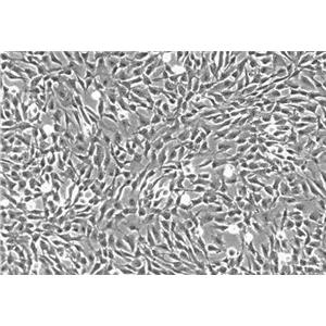 人胆囊成纤维细胞