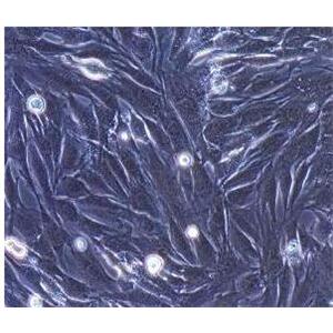 人胆囊平滑肌细胞,Human Gallbladder Smooth Muscle Cells