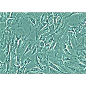 人胆囊微血管内皮细胞,Human Gallbladder Microvascular Endothelial Cells