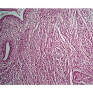 人食管纤维瘤细胞