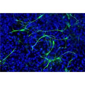 人神经干细胞,Human neural stem cell