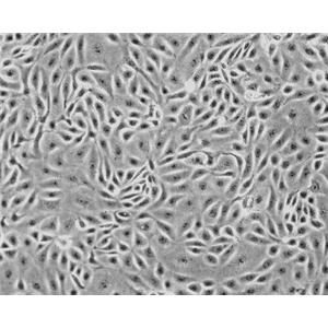 大鼠脉胳膜成纤维细胞