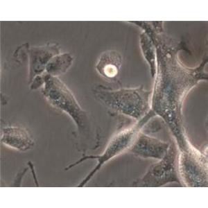 大鼠海马神经干细胞