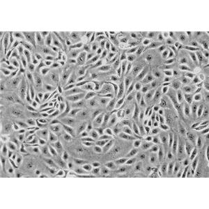 大鼠颈动脉成纤维细胞,Carotid Fibroblasts Cells