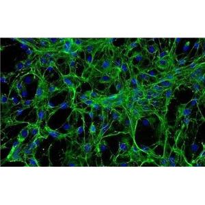 大鼠主动脉瓣膜间质细胞