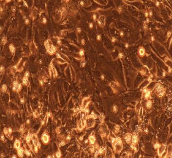 大鼠子宫平滑肌细胞,Rat Uterine Smooth Muscle Cells