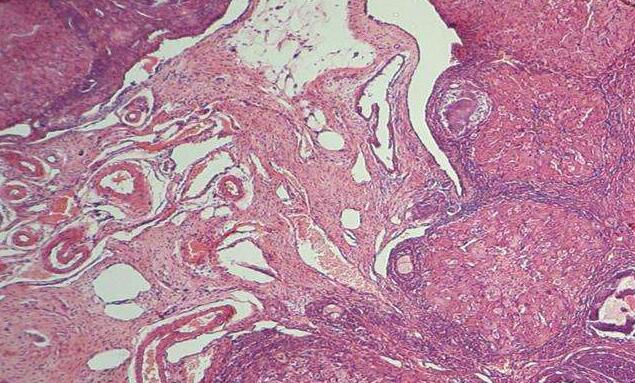 大鼠卵巢表面上皮细胞,Rat Ovarian Surface Epithelial Cells