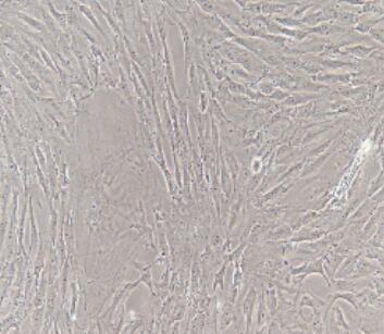 大鼠乳腺成纖維細(xì)胞,Rat Mammary Fibroblasts Cells