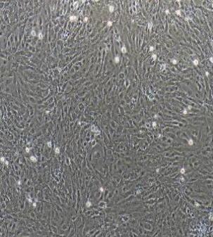 大鼠淋巴管内皮细胞,Rat Lymphatic Endothelial Cells