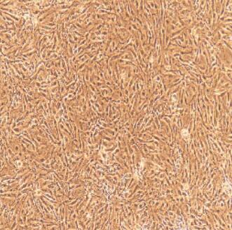 大鼠脉络膜微血管内皮细胞,Rat Choroidal Microvascular Endothelial Cells