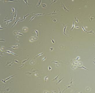 大鼠牙周膜成纤维细胞,Rat Periodontal Ligament Fibroblasts Cells