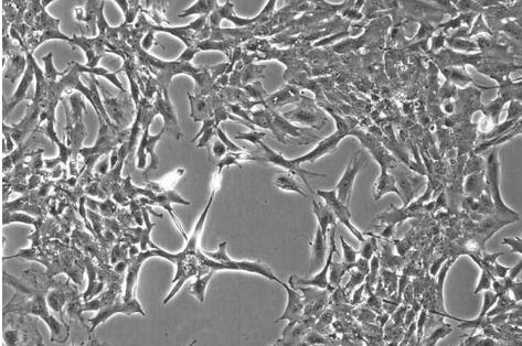 脈絡(luò)膜成纖維細(xì)胞,Rat Choroidal Fibroblasts Cells