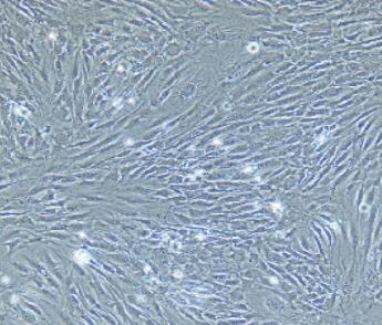 小鼠肺微血管内皮细胞,Pulmonary Microvascular Endothelial Cells