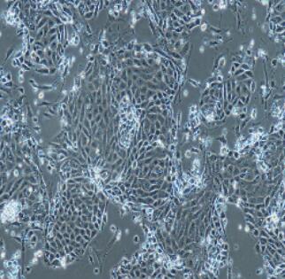 小鼠Ⅱ型肺泡上皮细胞,Type II Alveolar Epithelial Cells